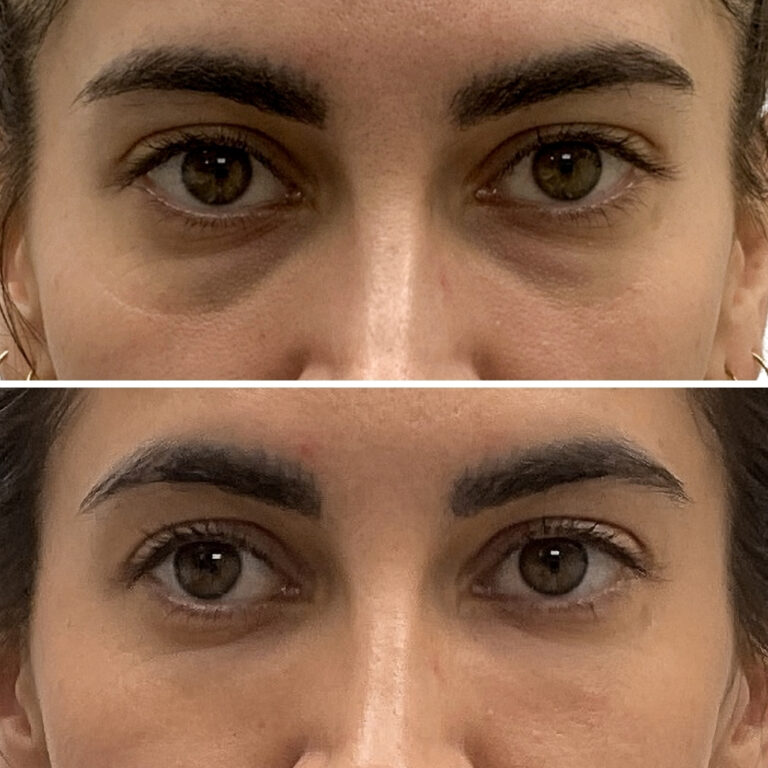 bright & tight before & after