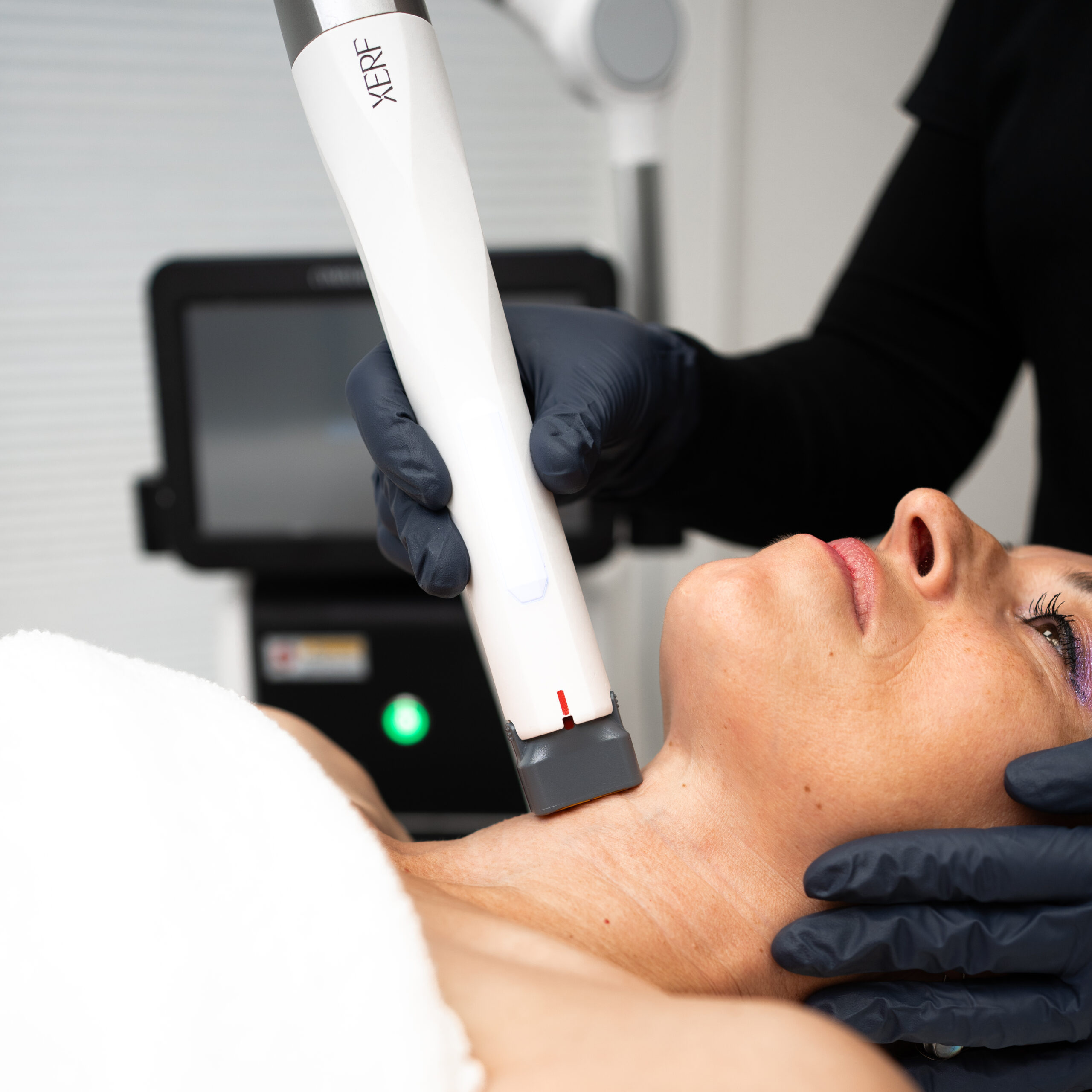 XERF at Skin Secrets